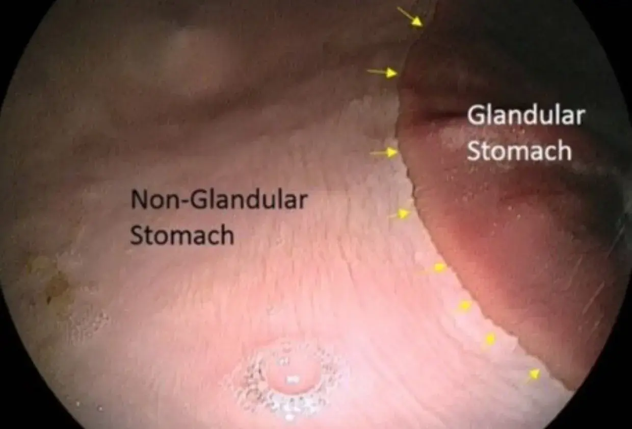 Gastroscopie cheval : vue endoscopique du cardia, marquant la limite entre l'estomac glandulaire et non glandulaire.