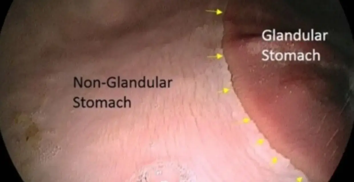 Gastroscopie cheval : vue endoscopique du cardia, marquant la limite entre l'estomac glandulaire et non glandulaire.