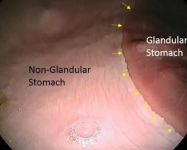 Gastroscopie cheval : vue endoscopique du cardia, marquant la limite entre l'estomac glandulaire et non glandulaire.